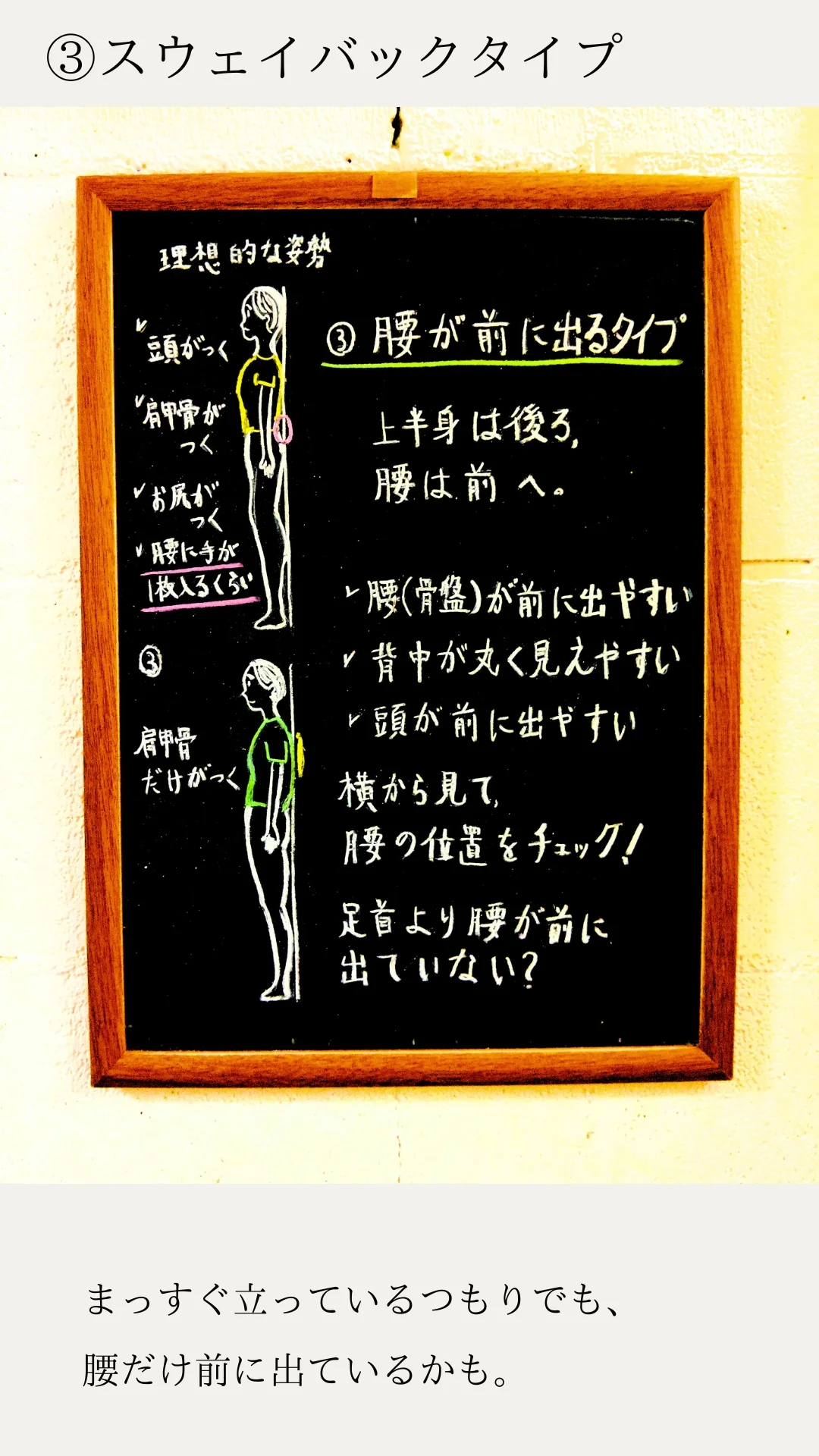 腰が前に出る姿勢と骨盤の位置を説明した黒板イラスト